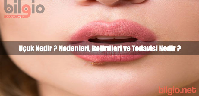 Herpes: belirtiler, tedavi Herpes: belirtiler, tedavi