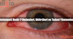 Coxarthrosis - nedir Nedenler, Belirtiler ve Tedavi Yöntemleri 23