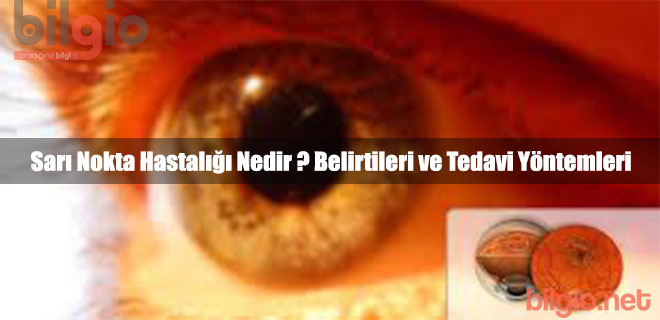 Karaciğerin yağ dejenerasyonu. Nedenleri, Belirtileri ve Tedavisi Karaciğerin yağ dejenerasyonu. Nedenleri, Belirtileri ve Tedavisi