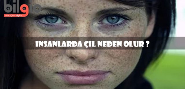 Çil Nedir ? İnsanlarda Çil Neden Olur ?