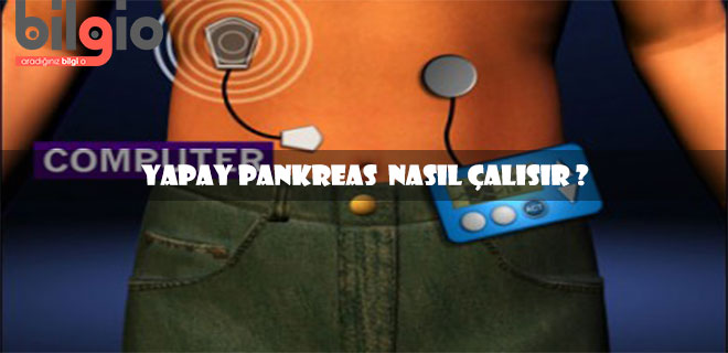 yapay-pankreas-nasıl-çalışır