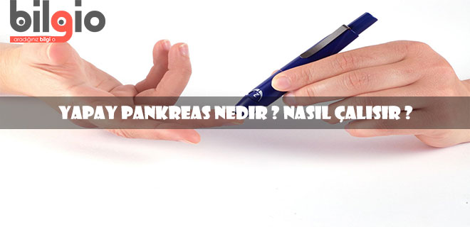 Diyabet Hastalarının Umutla Beklediği Yapay Pankreas Nedir ?