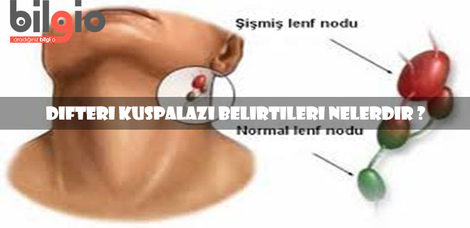 difteri-kuşpalazı-belirtileri