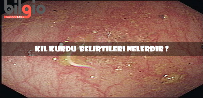 Kıl Kurdu Nedir Neden Olur Tedavisinde Kullanılan İlaçlar Kıl Kurdu Nedir Neden Olur Tedavisinde Kullanılan İlaçlar