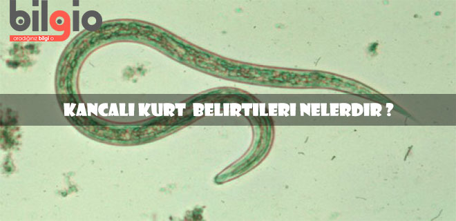 kancalı-kurt-belirtileri
