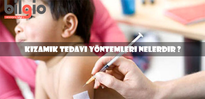 kızamık-tedavisi
