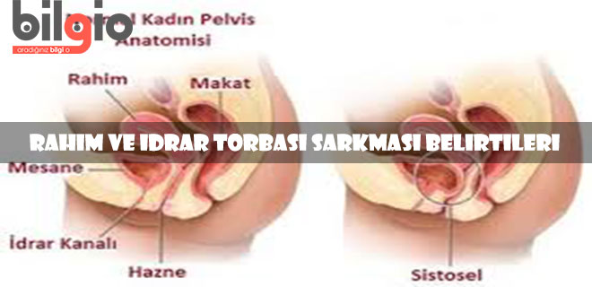 idrar-sarkması-belirtileri