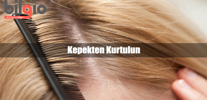 kepekten-kurtulma