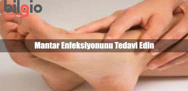 mantar-enfeksiyonu-tedavisi