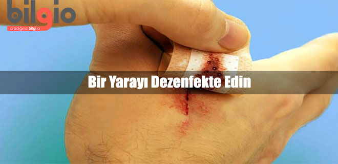yarayi-dezenfekte-etme