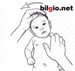 Bebeklerde tortikolis egzersizleri 